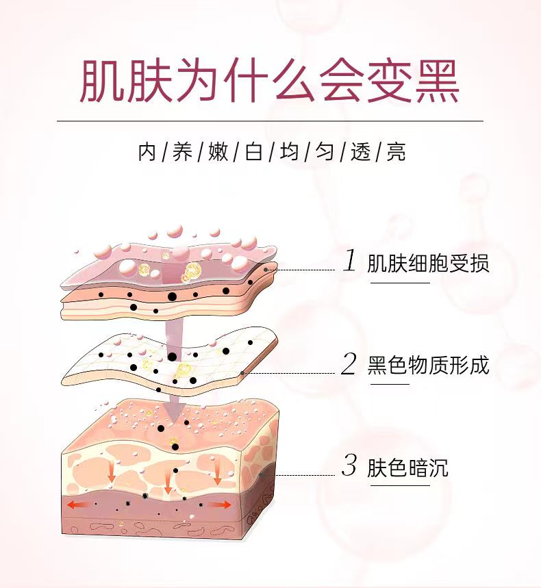 亭叶尖酸4.jpg